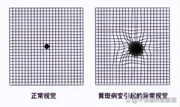 看东西变小